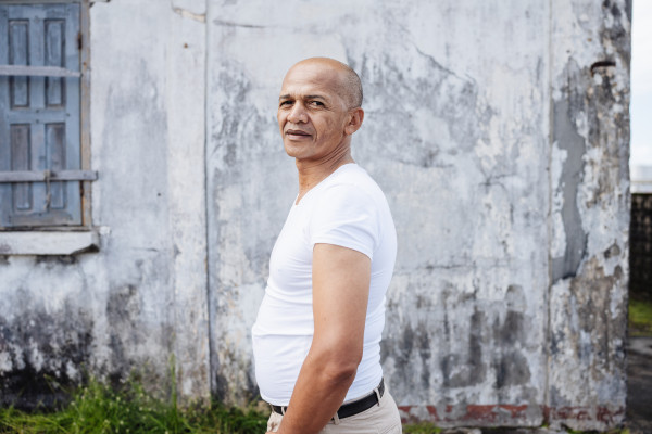 For the first time in 15 years, farmer can sleep on his back after tumor removal by Mercy Ships 3 Back turmour removed