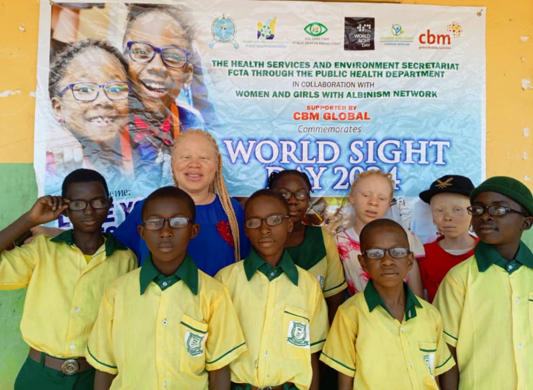 Excitement as partially blind students see whiteboard, teacher clearer 1 IMG 20241023 WA0022