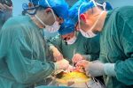 Pig liver transplant in human