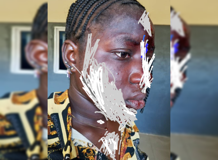 Taraba woman mutilates face of 17-year old girl over husband's sexual advance